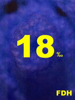 Blaues FDH-Plakat mit gelbem 18 Promille.